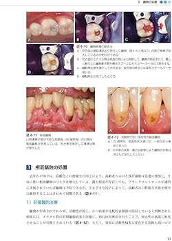 保存修復学 第7版 | 千田 彰, 宮崎 真至, 林 美加子, 向井 義晴, 斎藤
